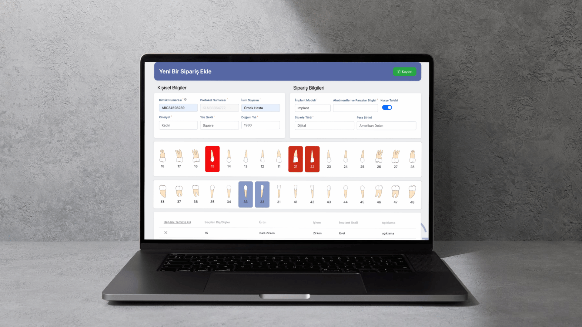Diş Laboratuvarı Yazılımı